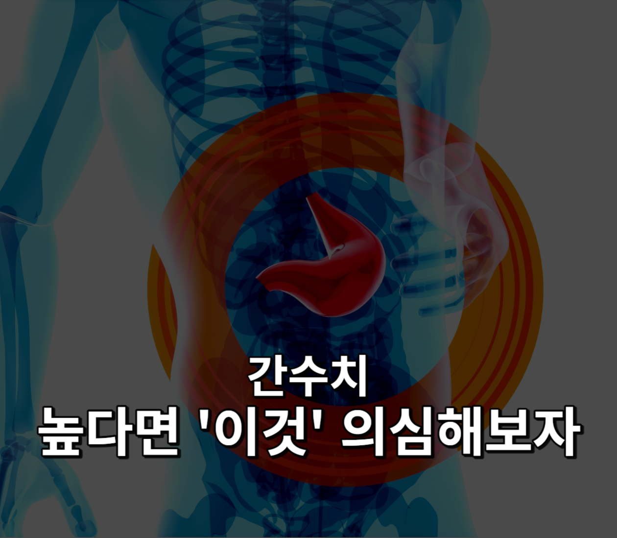 간수치 높아면 이것 의심해보자